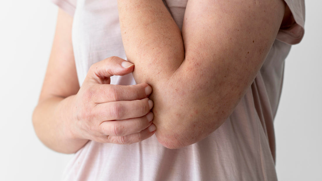 Dermatite da contatto: cause e rimedi